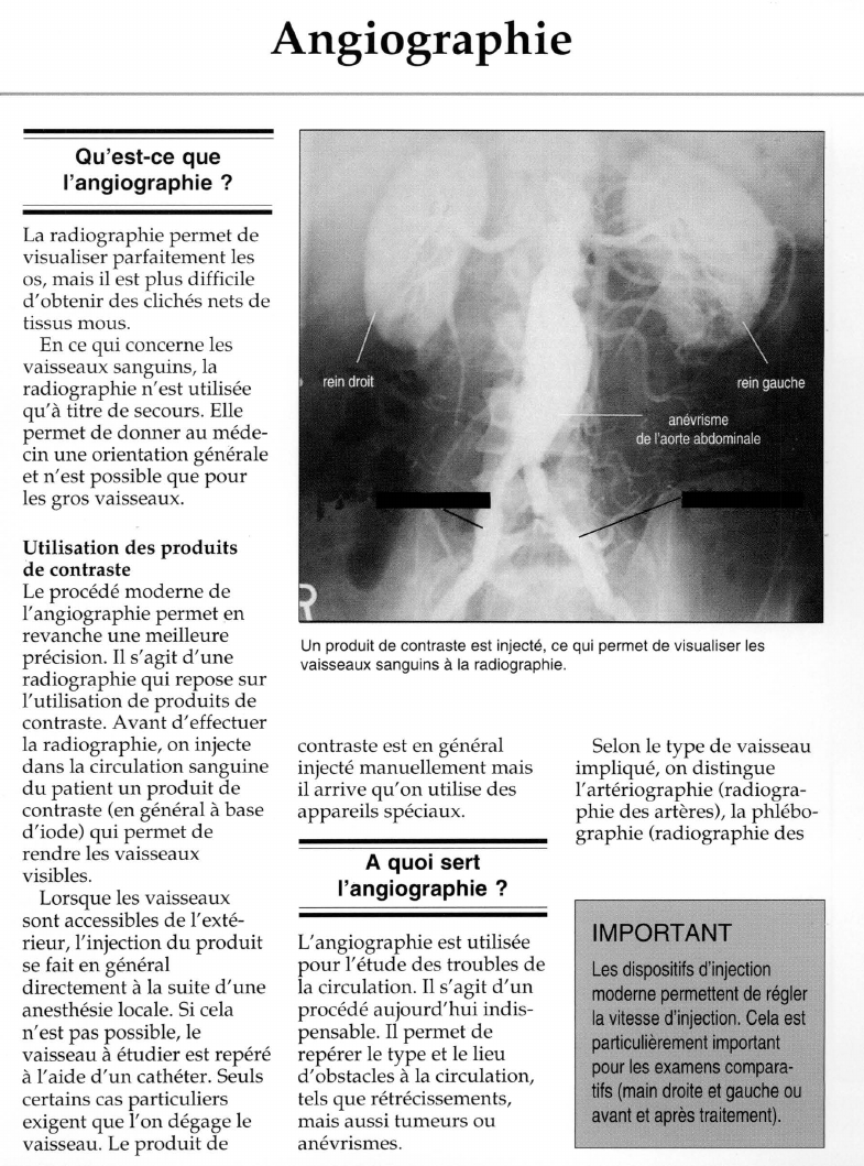 Prévisualisation du document Angiographie.