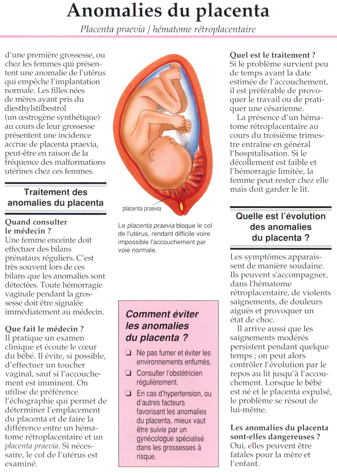 Prévisualisation du document Anomalies du placenta : Placenta praevia /hématome rétroplacentaire