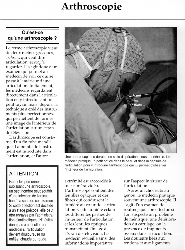 Prévisualisation du document Arthroscopie.
