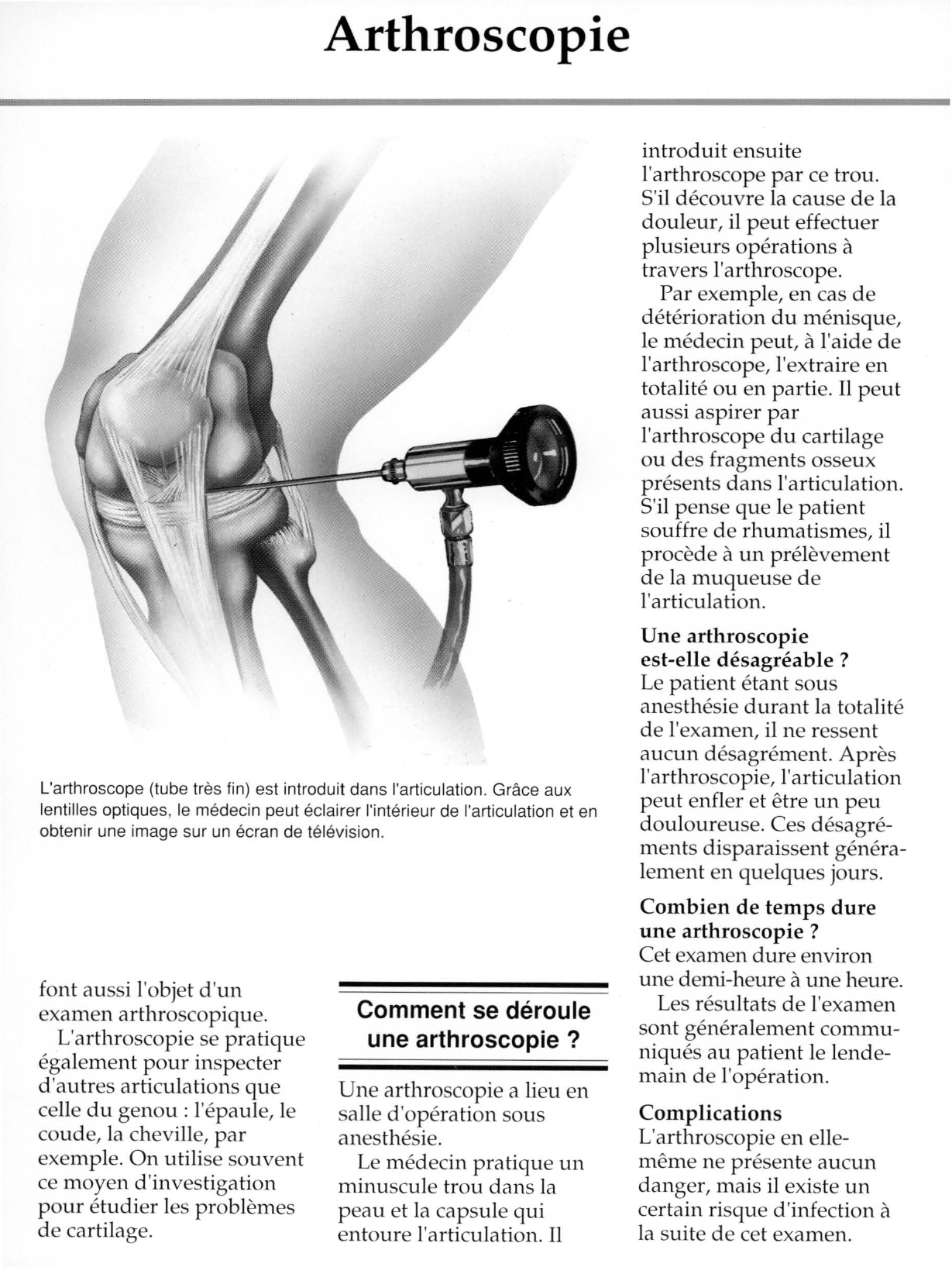 Prévisualisation du document Arthroscopie.