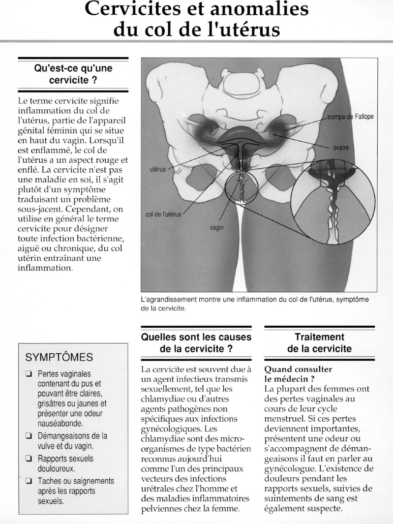 Prévisualisation du document Cervicites et anomaliesdu col de l'utérus.