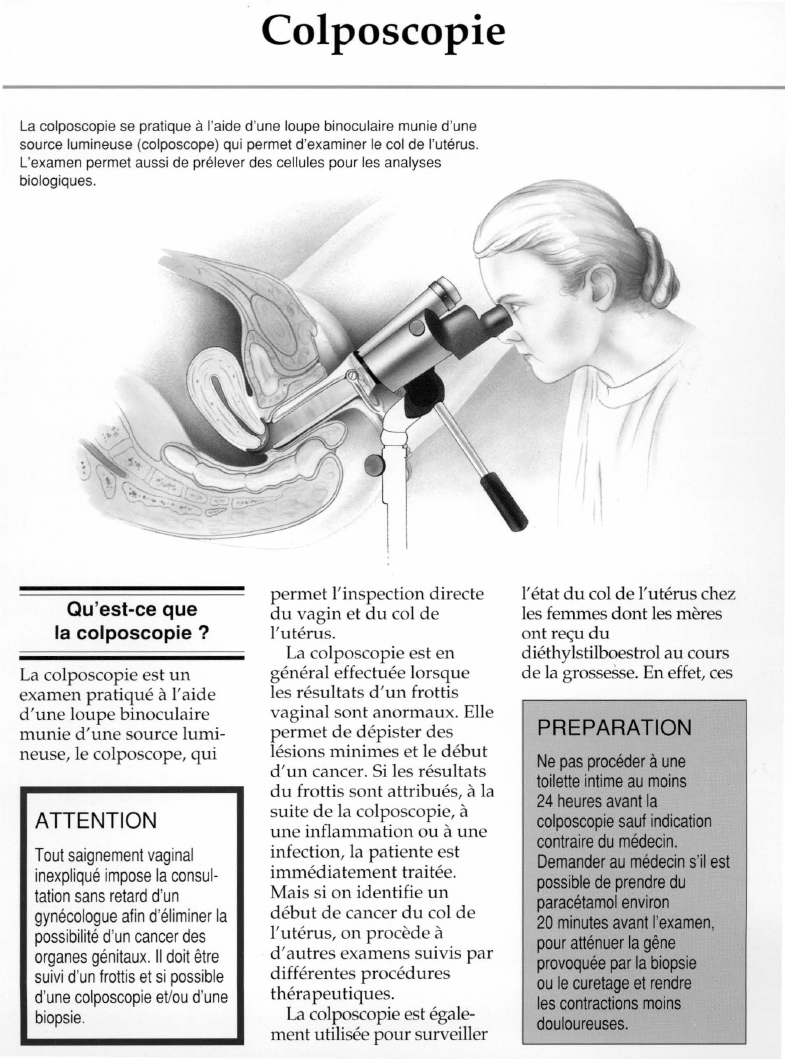 Prévisualisation du document Colposcopie.
