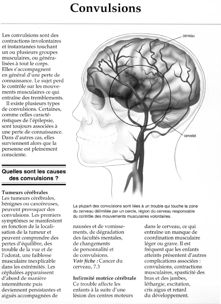 Prévisualisation du document Convulsions.