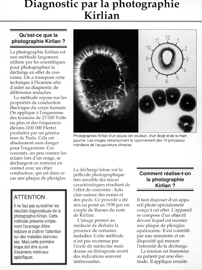 Prévisualisation du document Diagnostic par la photographieKirlian.