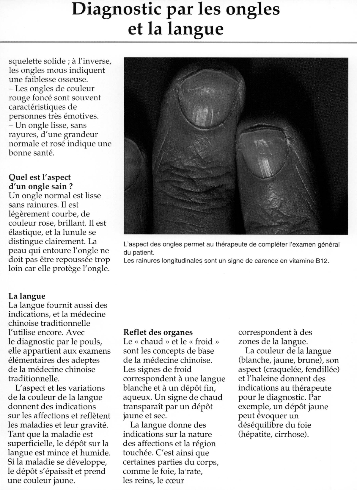 Prévisualisation du document Diagnostic par les ongles
et la langue.
