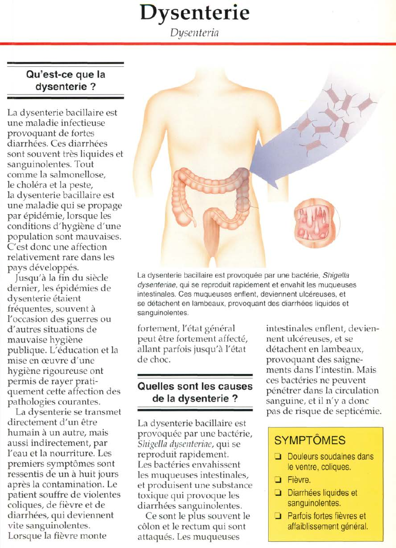 Prévisualisation du document Dysenterie