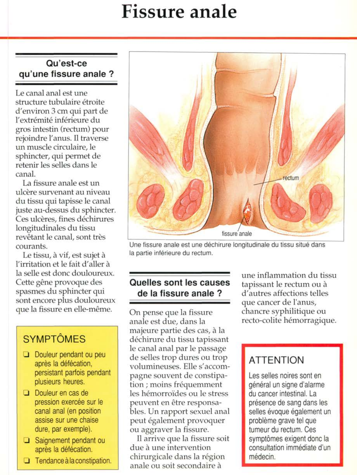 Prévisualisation du document Fissure anale