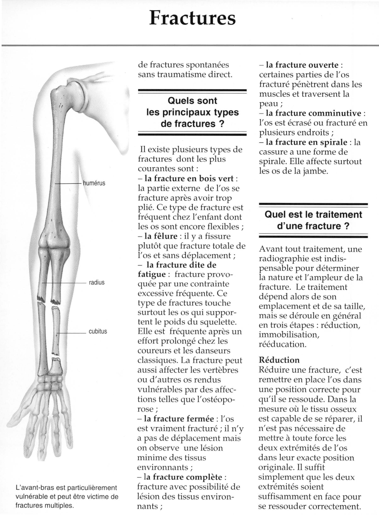 Prévisualisation du document Fractures.