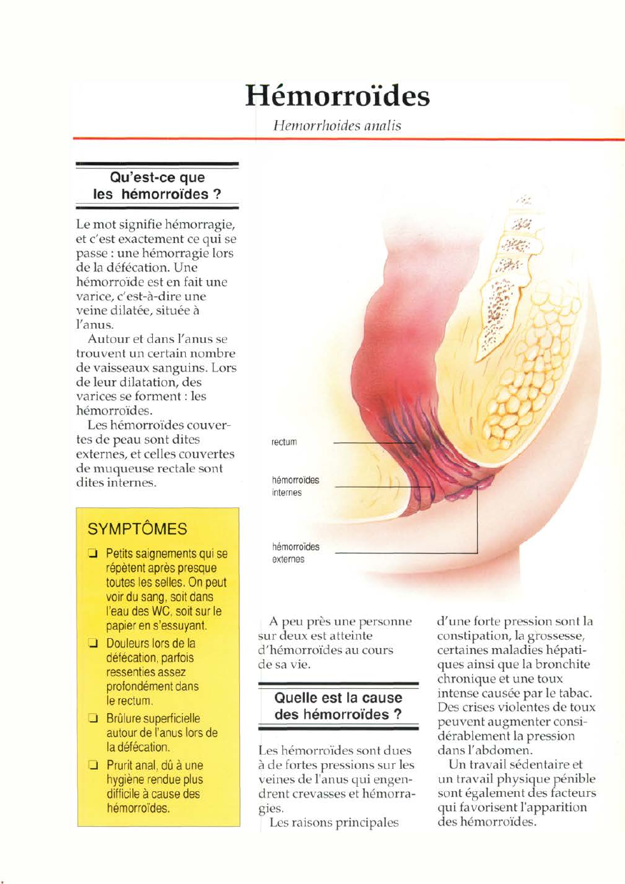 Prévisualisation du document Hémorroïdes