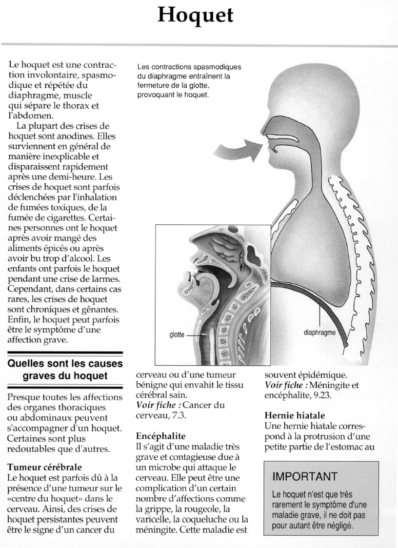 Prévisualisation du document Hoquet.