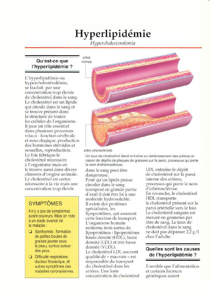 Prévisualisation du document Hyperlipidémie