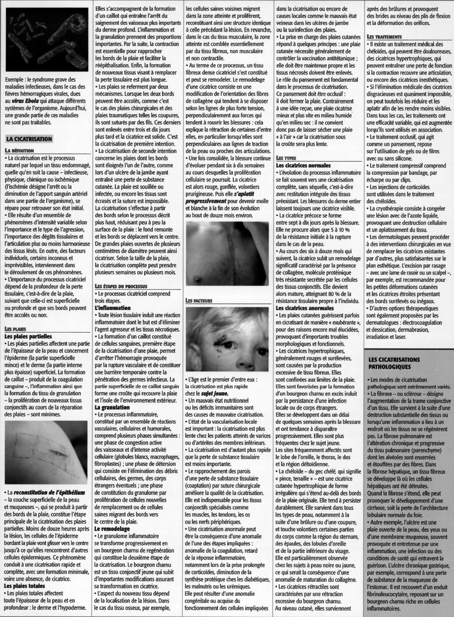 Prévisualisation du document Inflammation & Cicatrisation