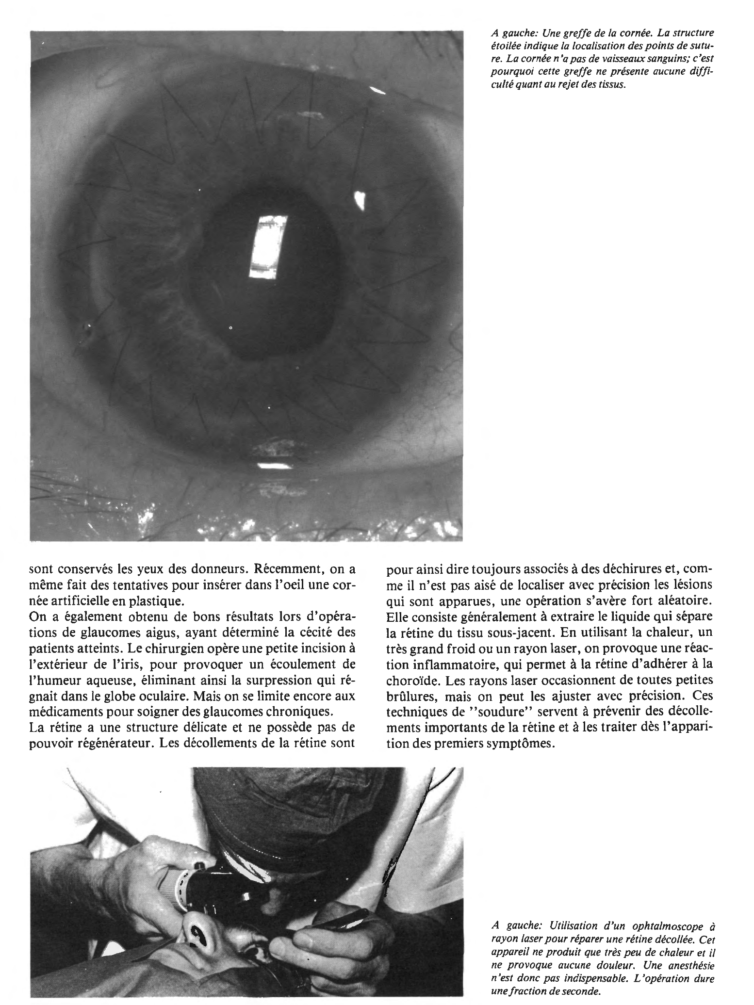 Prévisualisation du document La chirurgie de l'oeil