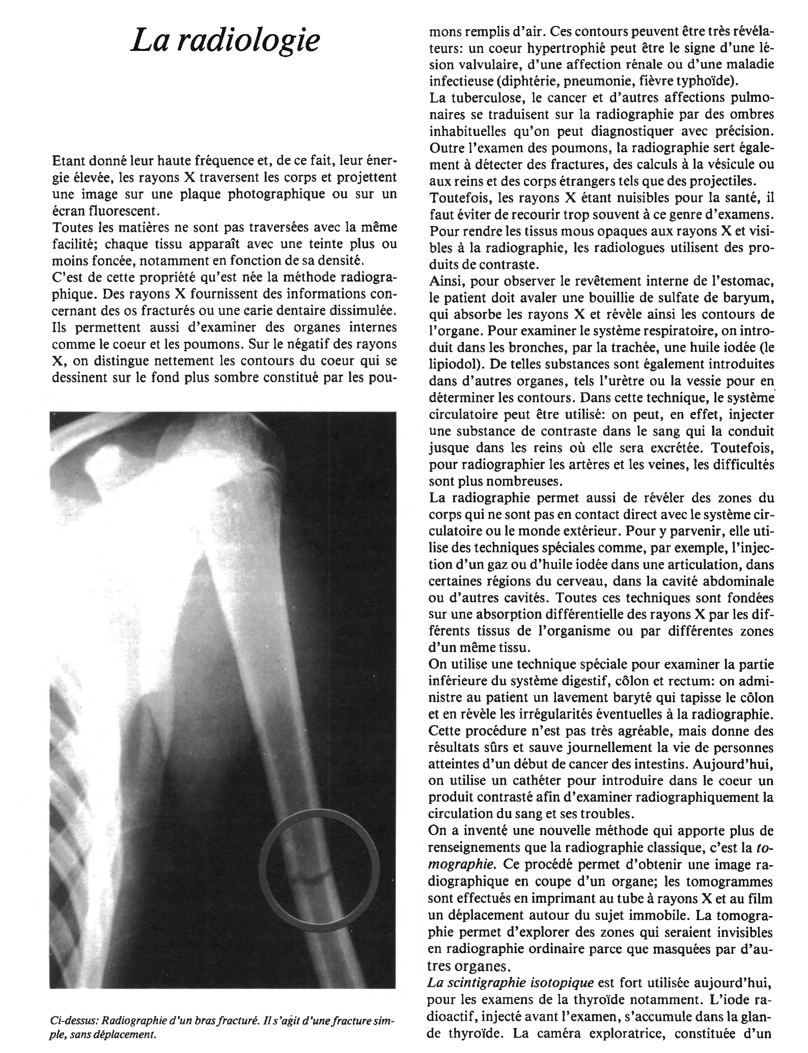 Prévisualisation du document La radiologie