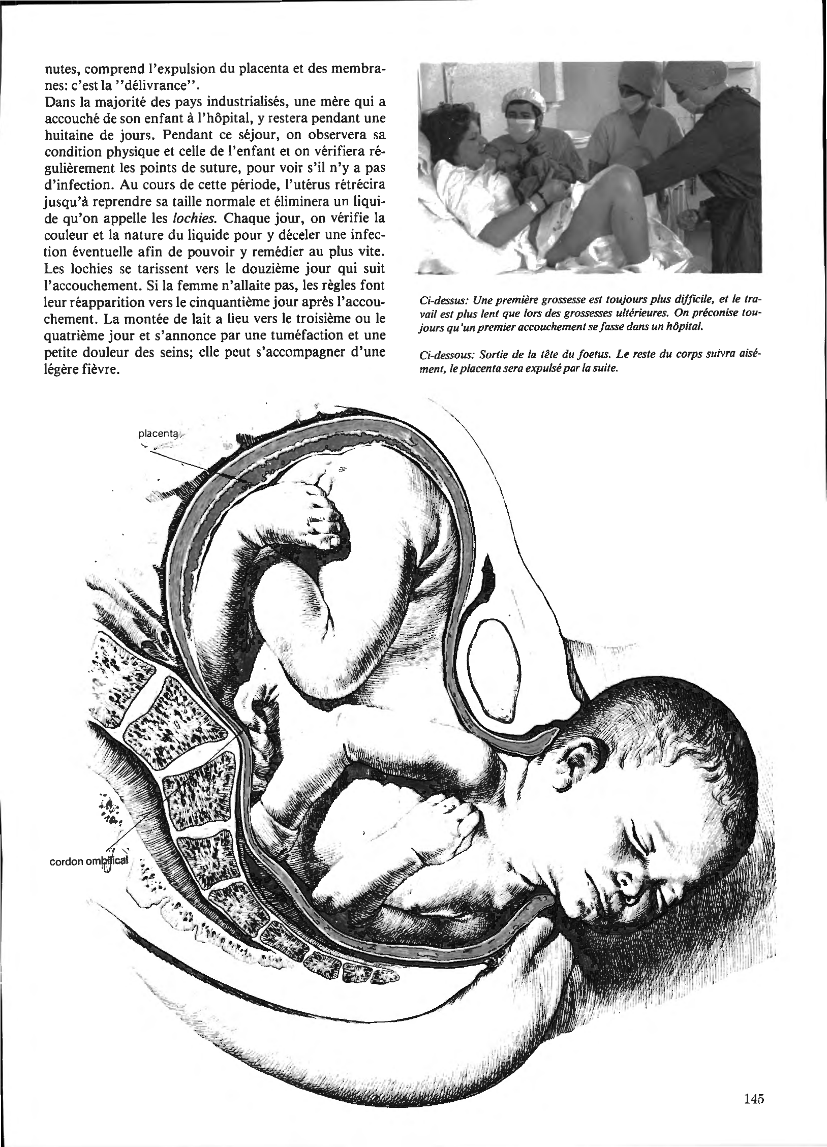 Prévisualisation du document L'accouchement et la délivrance