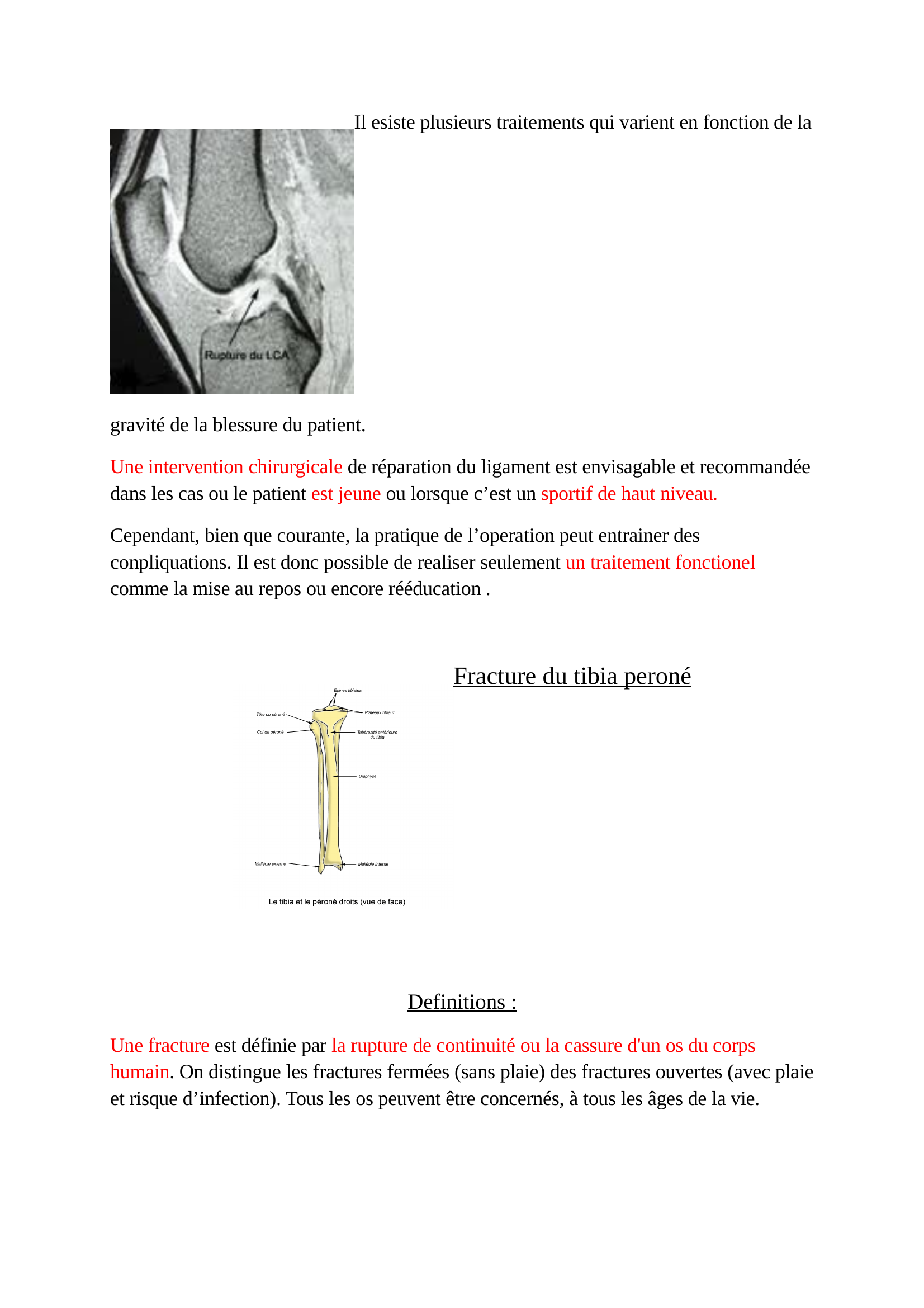 Prévisualisation du document les blessures liés au sport: la rupture des ligaments croisés; la crampe et la fracture du tibia peronnée SVT seconde