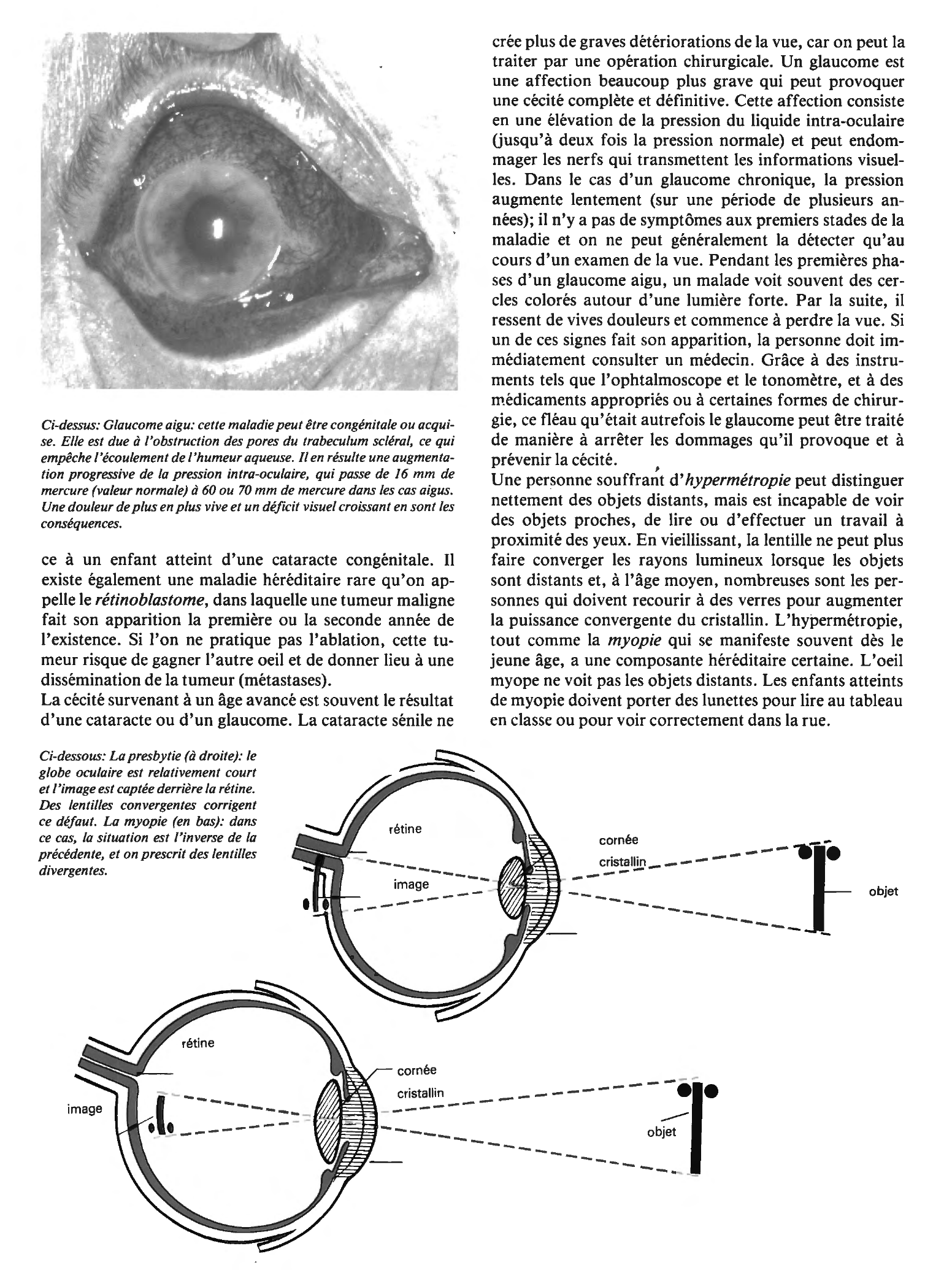 Prévisualisation du document Les lésions de l'oeil