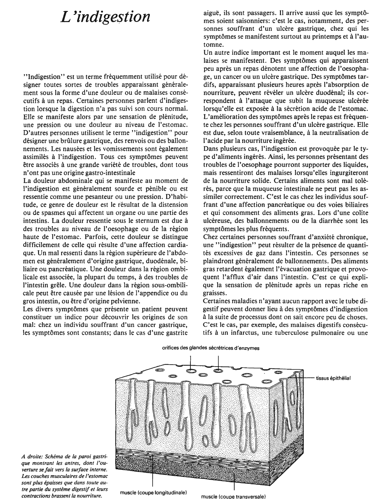 Prévisualisation du document L'indigestion