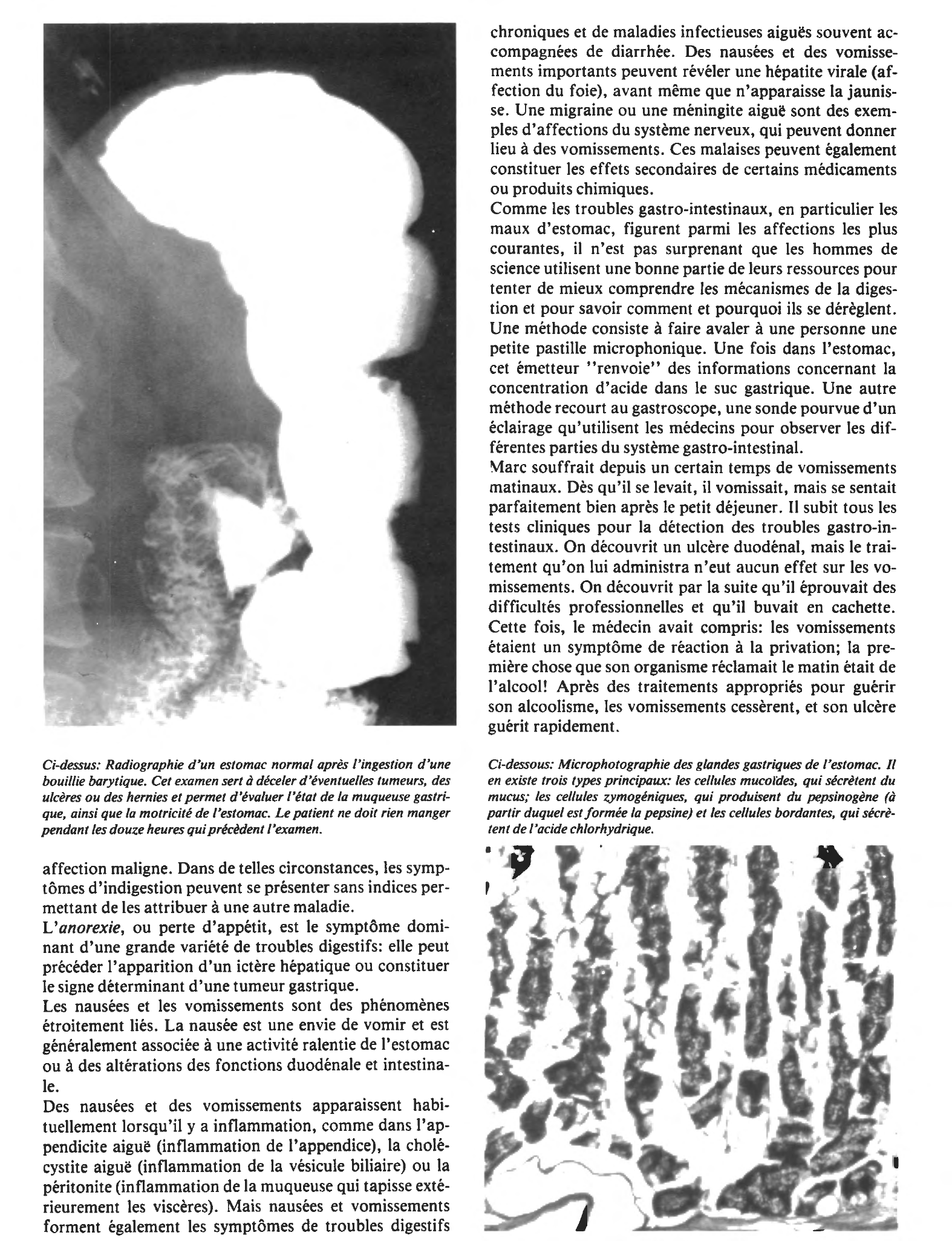 Prévisualisation du document L'indigestion