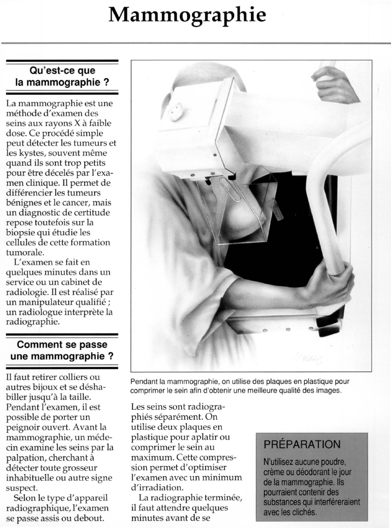 Prévisualisation du document Mammographie.