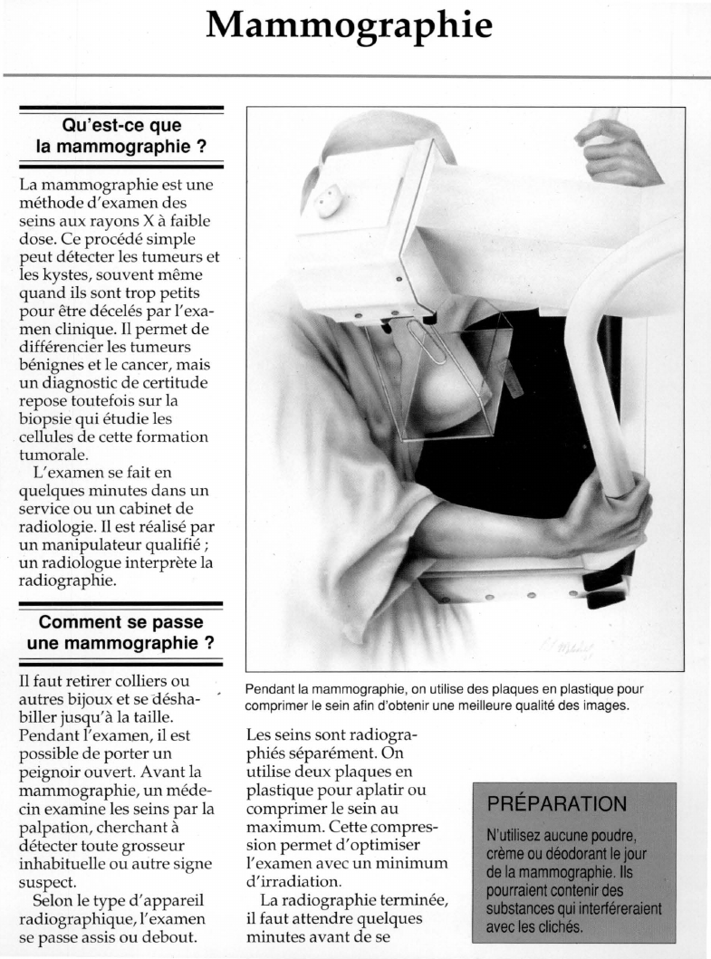 Prévisualisation du document Mammographie.