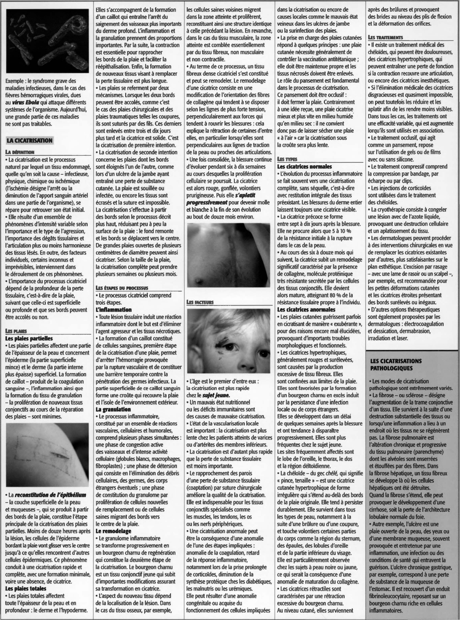 Prévisualisation du document Médecine: inflammation et cicatrisation