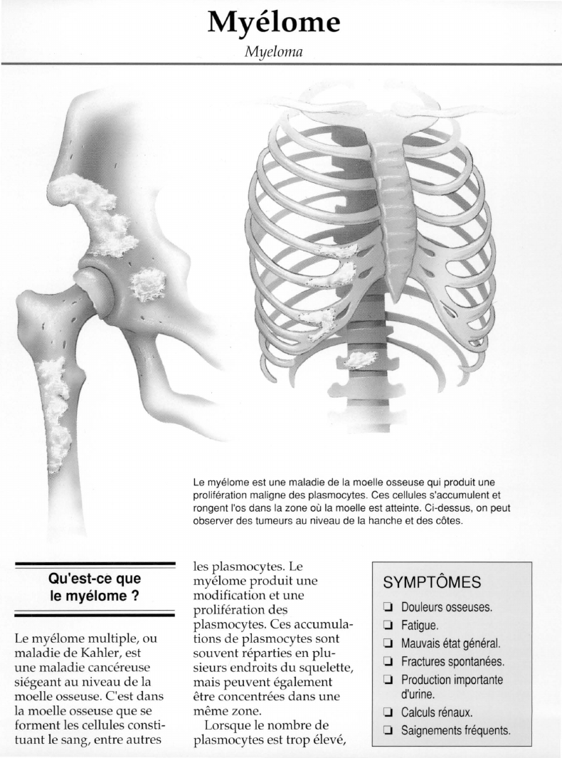 Prévisualisation du document Myélome.