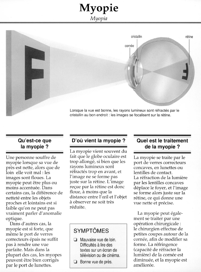 Prévisualisation du document Myopie.