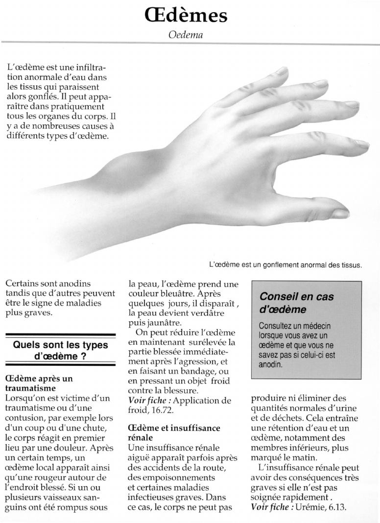 Prévisualisation du document OEdèmes.