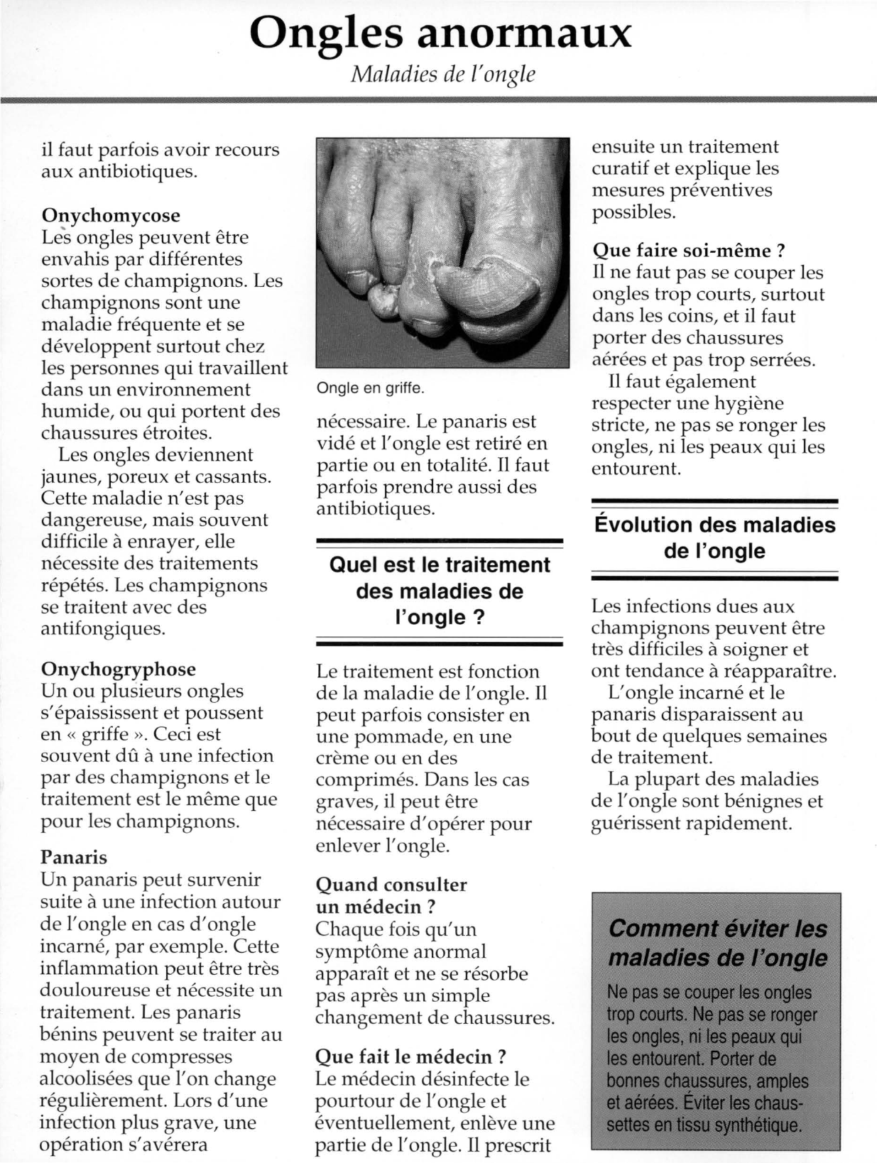 Prévisualisation du document Ongles anormaux.