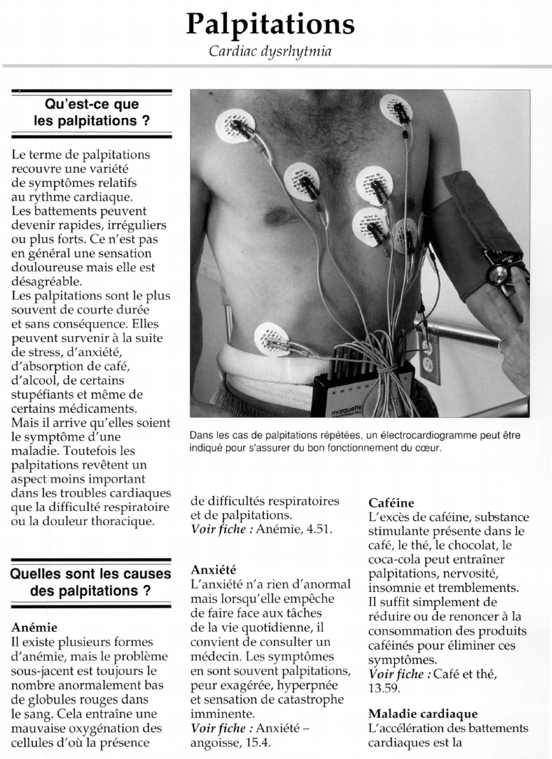 Prévisualisation du document Palpitations.