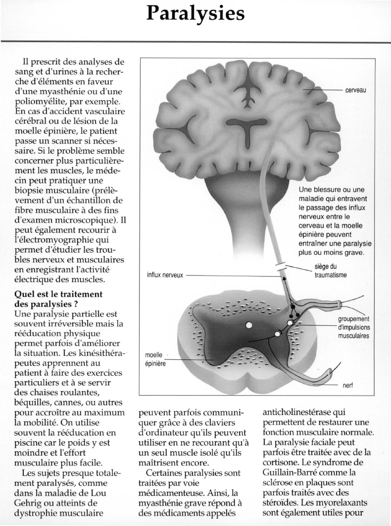 Prévisualisation du document Paralysies:cerveau.