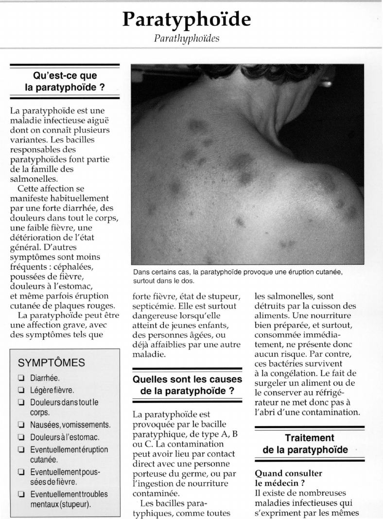 Prévisualisation du document Paratyphoïde.