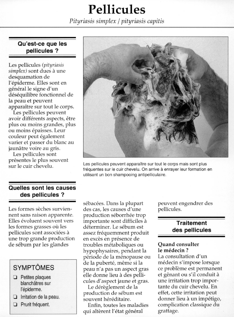 Prévisualisation du document Pellicules.