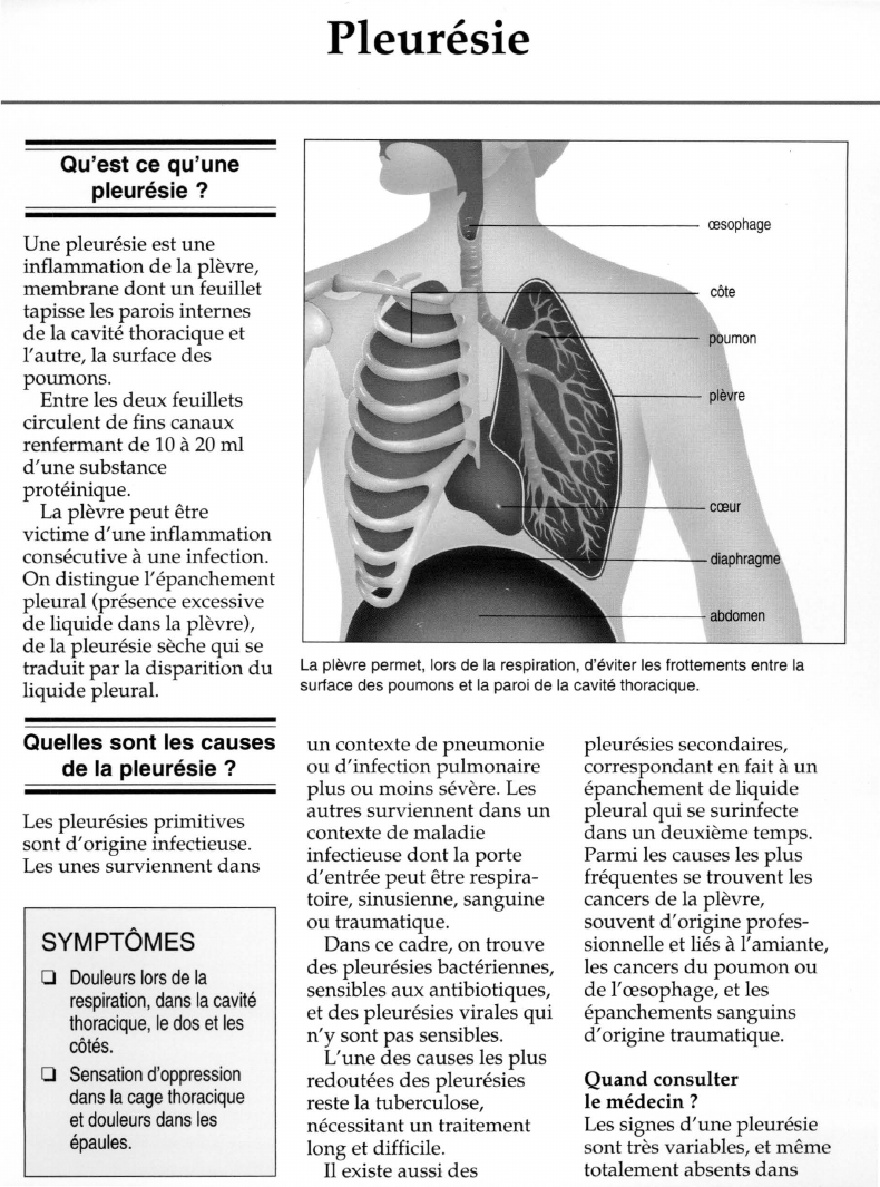 Prévisualisation du document Pleurésie.