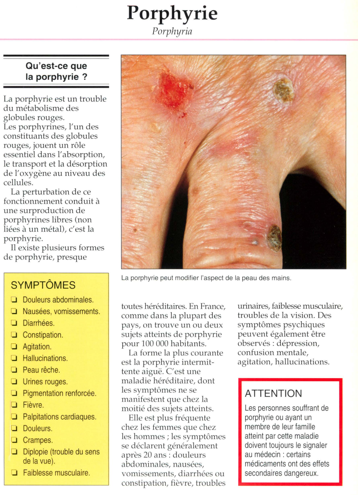 Prévisualisation du document Porphyrie