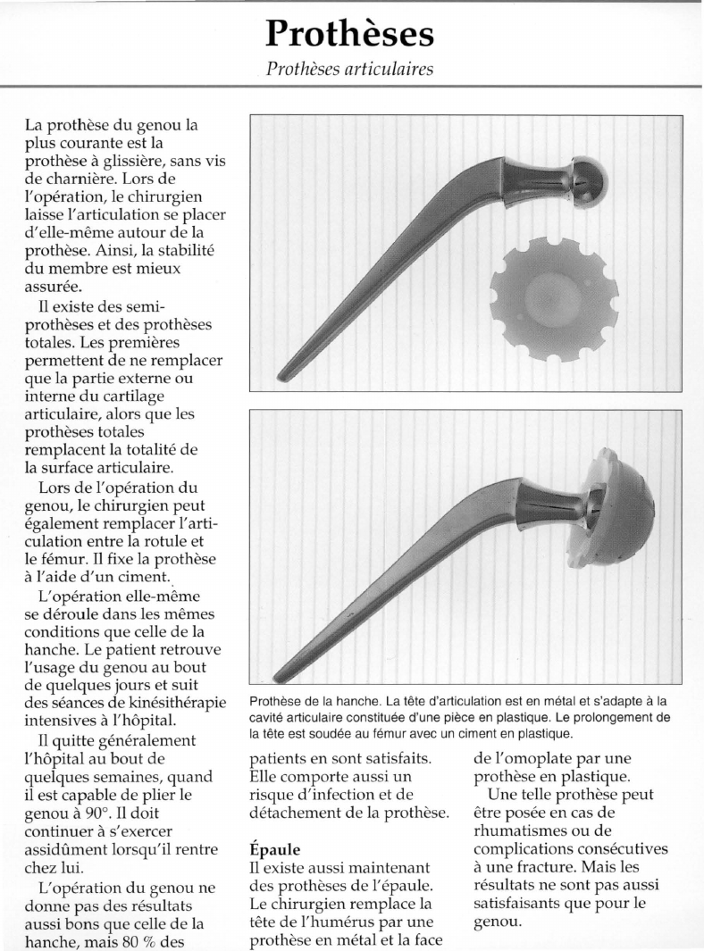 Prévisualisation du document Prothèses.