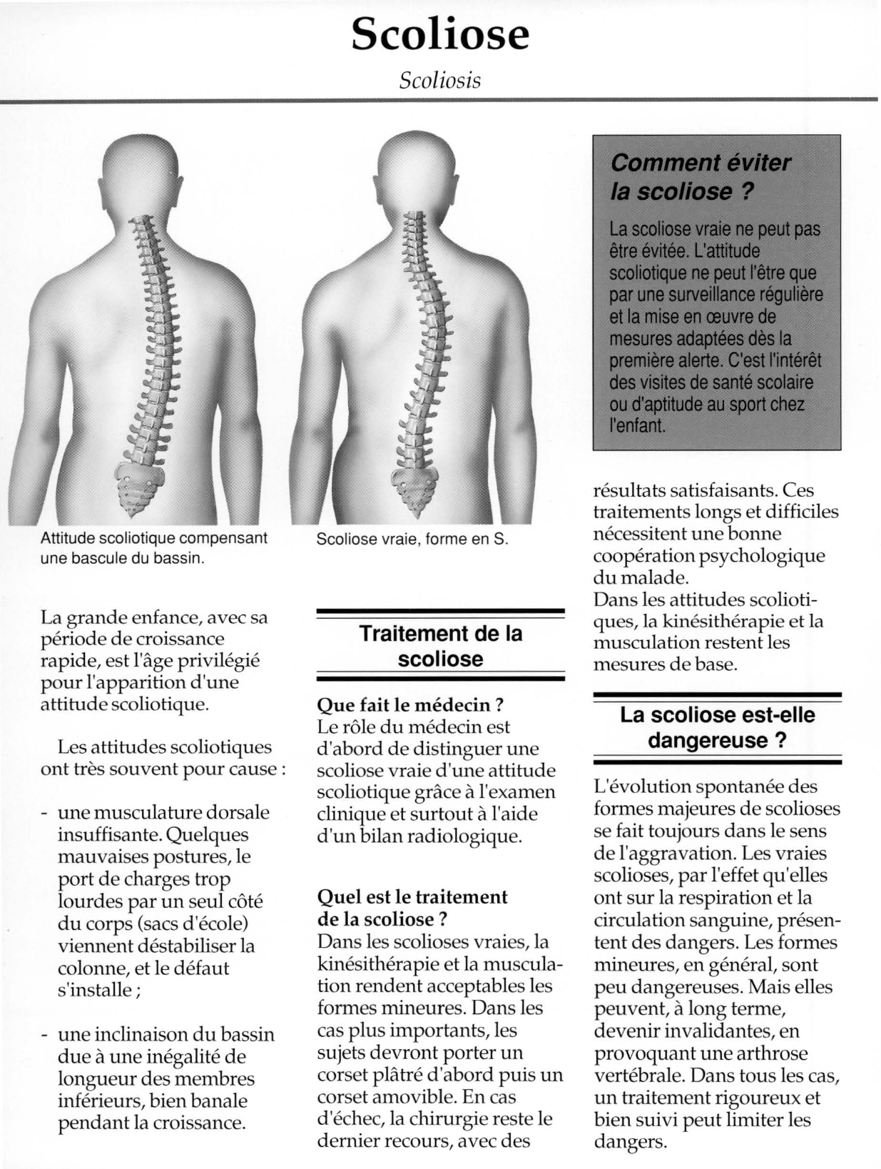 Prévisualisation du document Qu'est-ce que
la scoliose ?