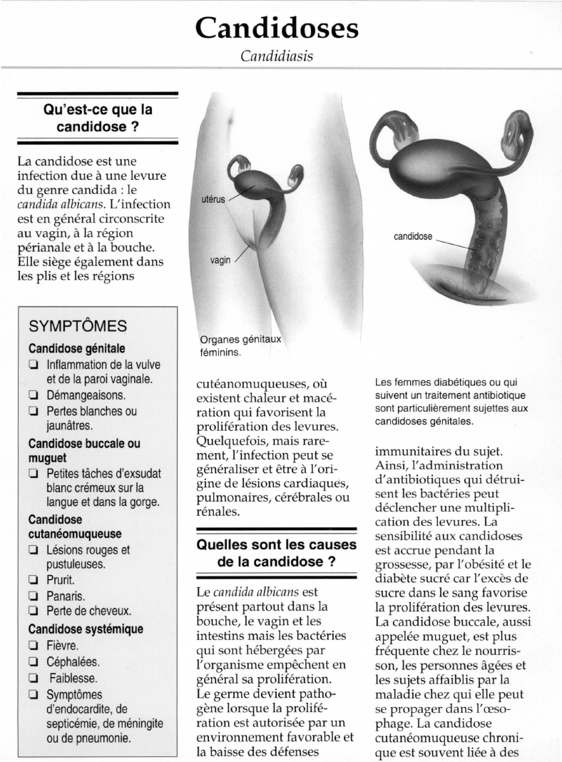 Prévisualisation du document Qu'est-ce que lacandidose ?