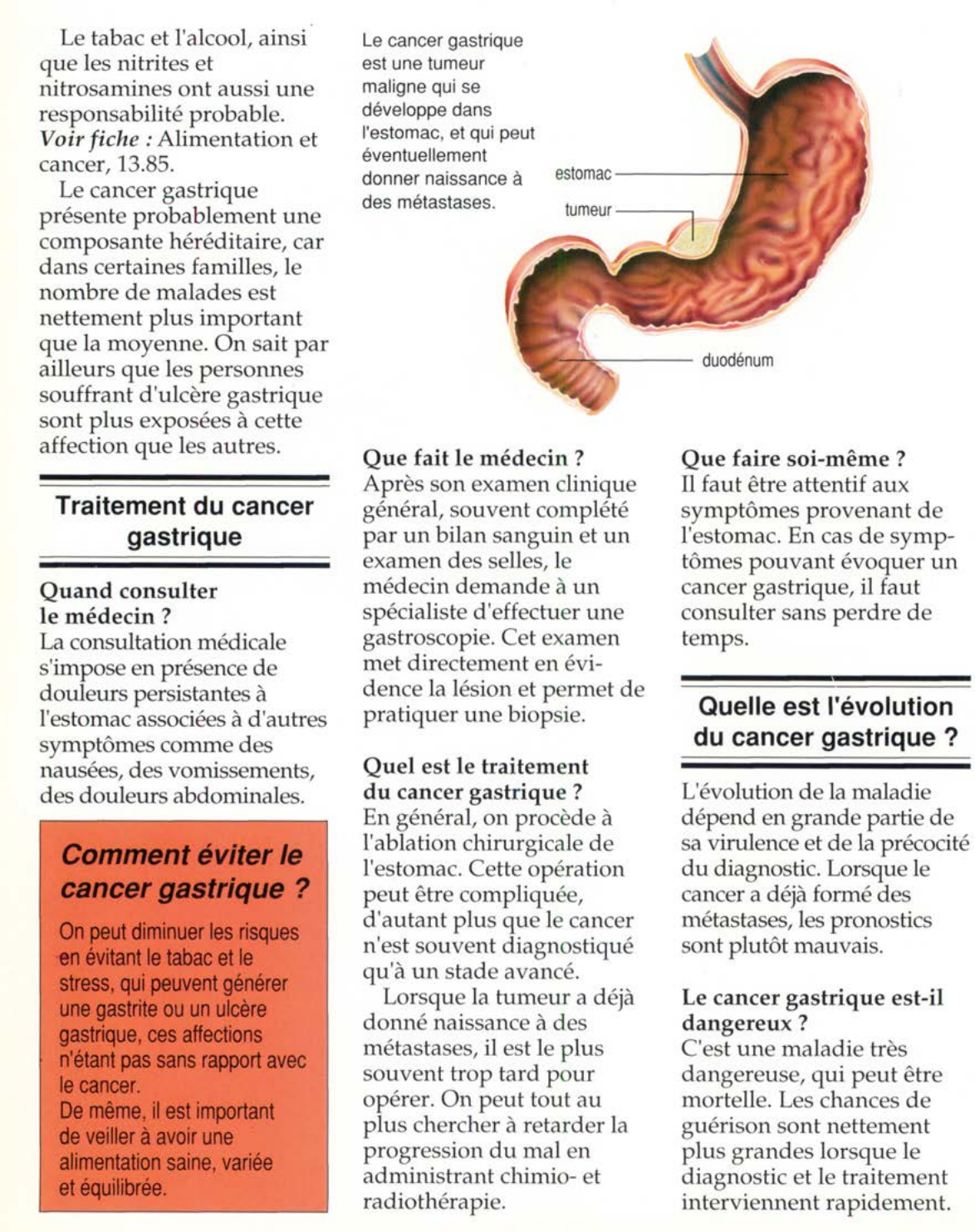 Prévisualisation du document Qu'est-ce que le cancer gastrique ?