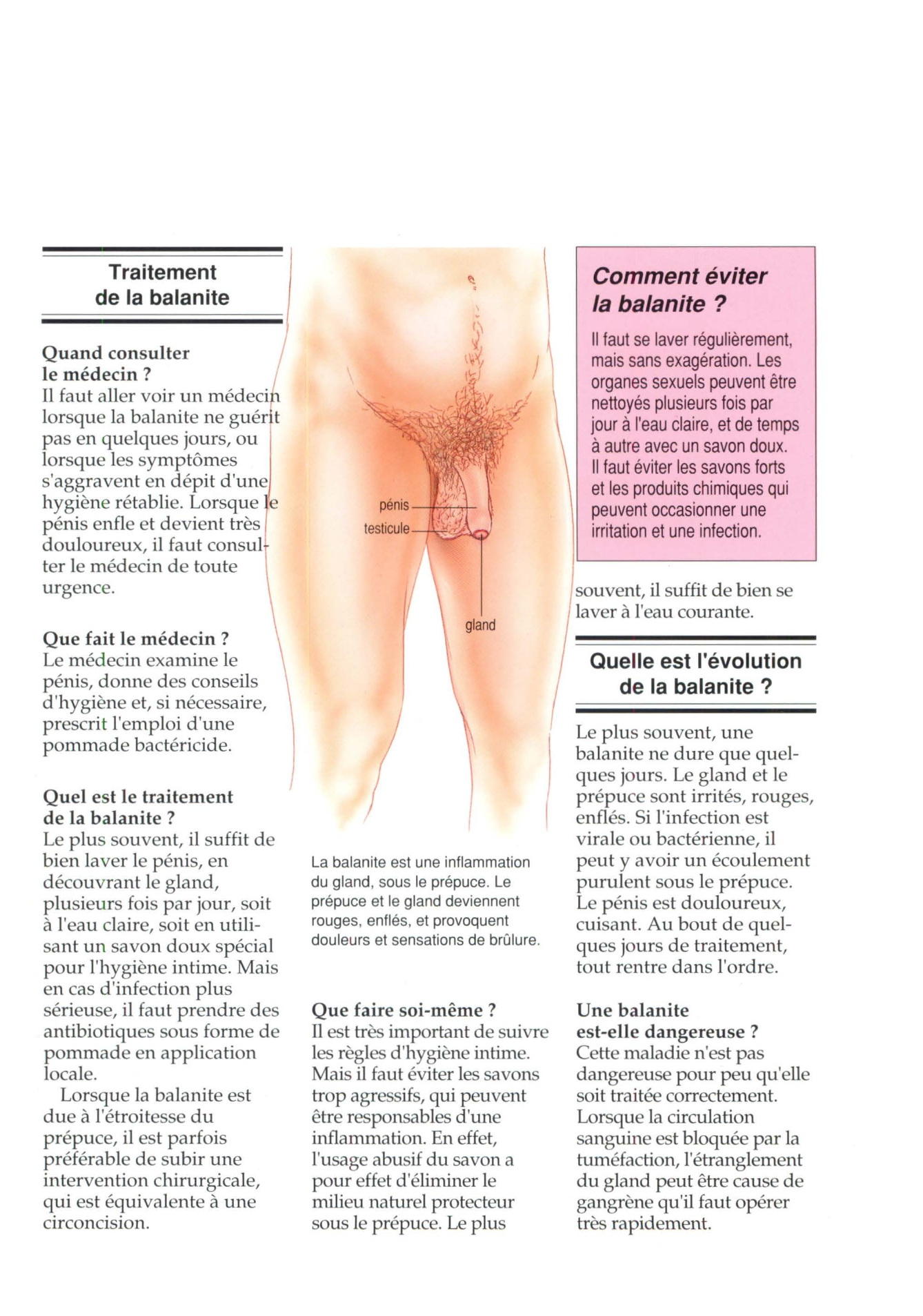 Prévisualisation du document Qu'est-ce qu'une balanite ?