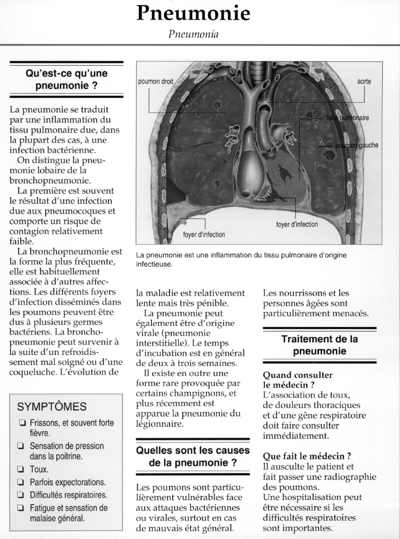 Prévisualisation du document Qu'est-ce qu'unepneumonie ?