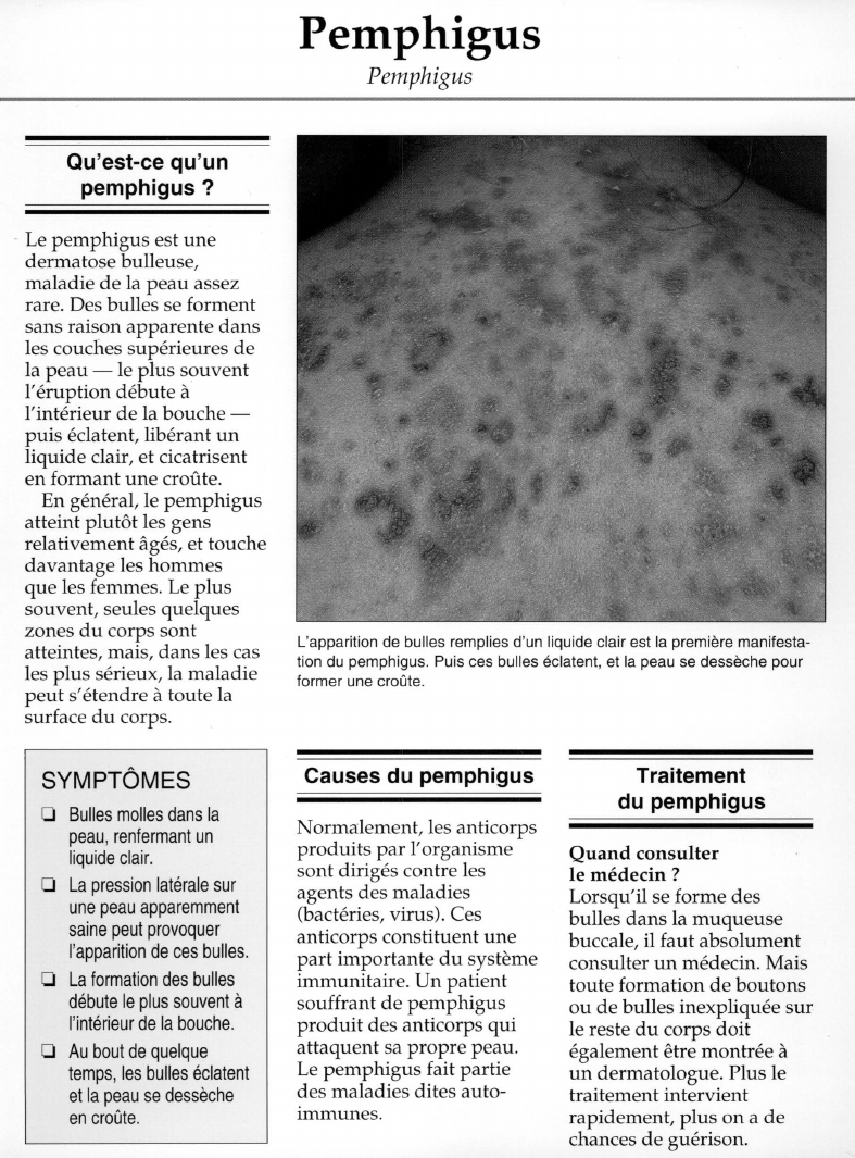 Prévisualisation du document Qu'est-ce qu'unpemphigus ?