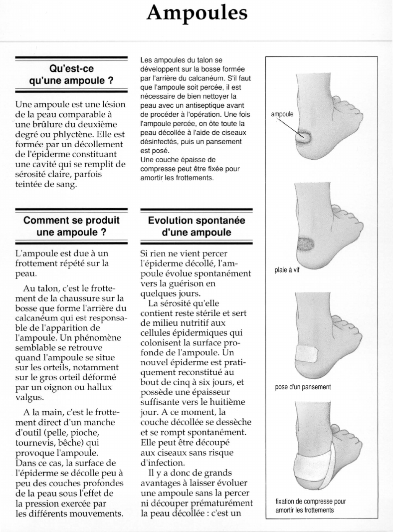 Prévisualisation du document Qu'est-cequ'une ampoule ?