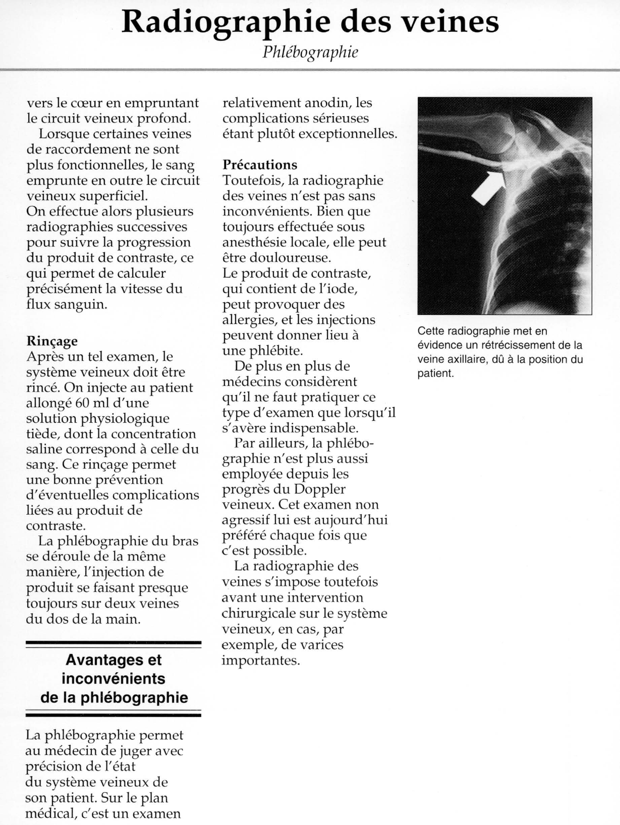 Prévisualisation du document Radiographie des veines.