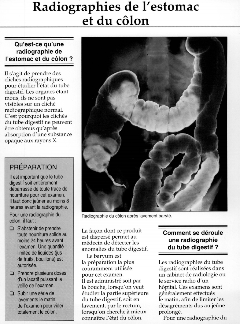 Prévisualisation du document Radiographies de l'estomacet du côlon.