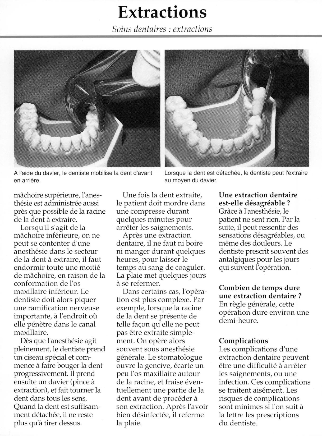 Prévisualisation du document Soins dentaires : extractions.