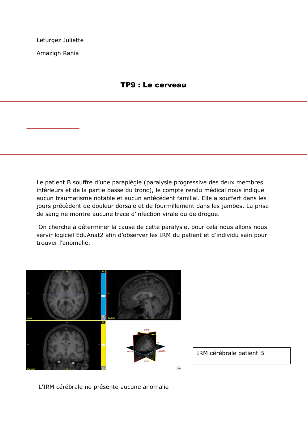 Prévisualisation du document tp cerveau svt