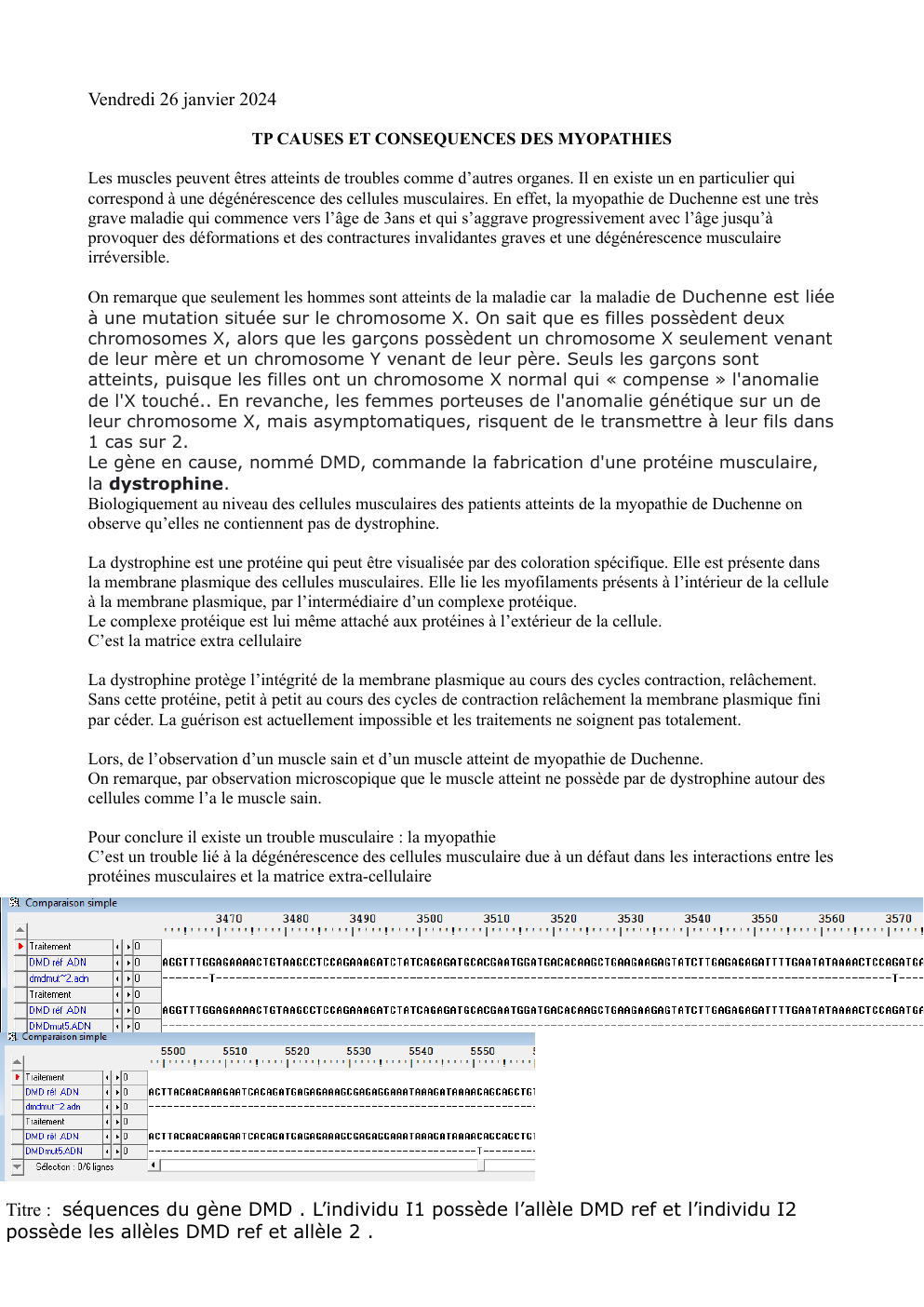 Prévisualisation du document tp maladie de duchenne