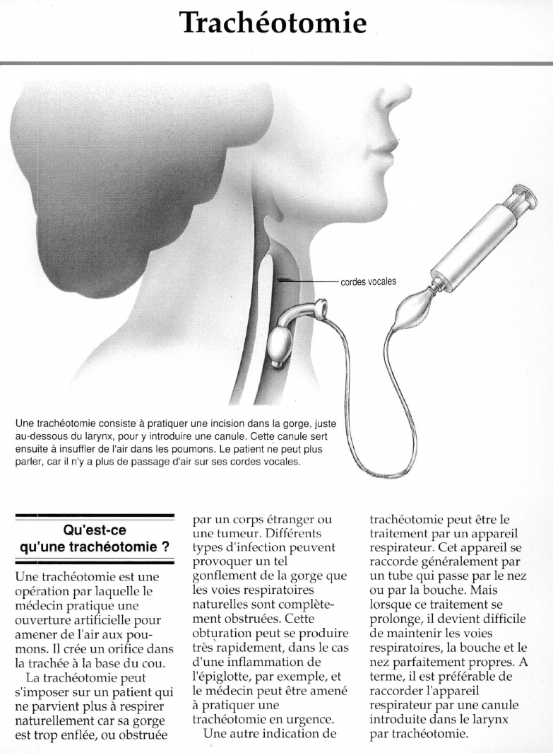 Prévisualisation du document Trachéotomie.